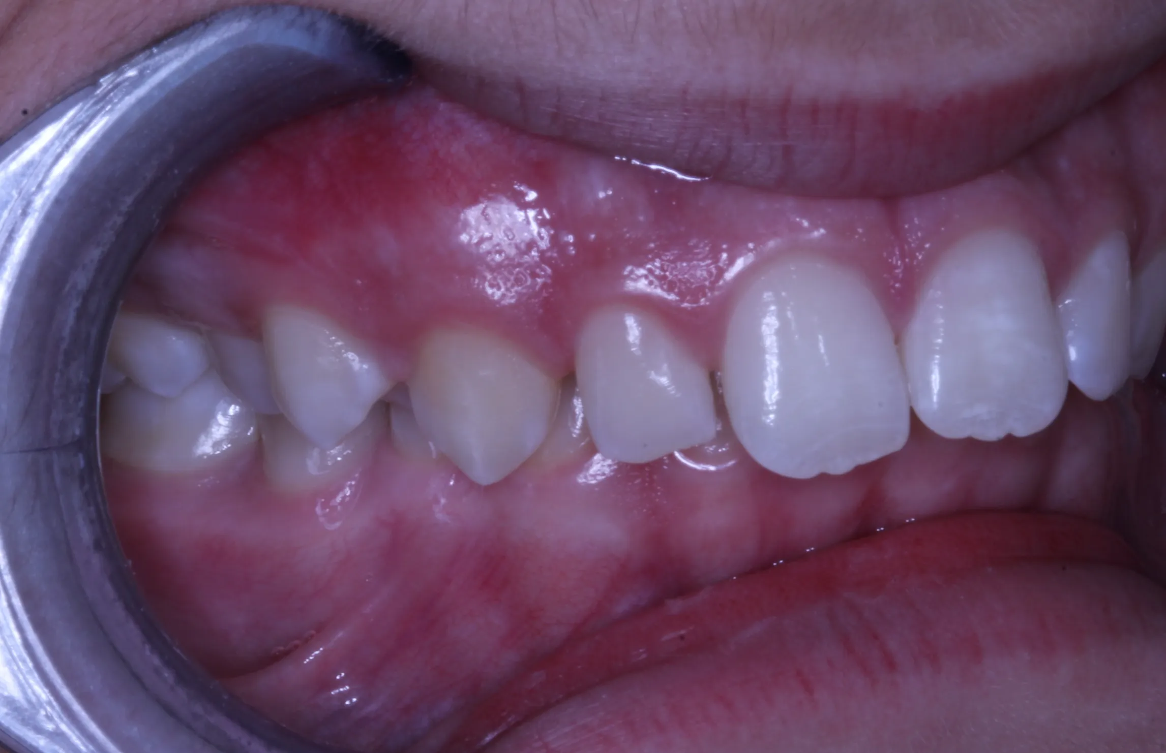 smile-gallery gallery